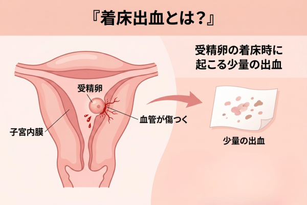 着床出血とは?