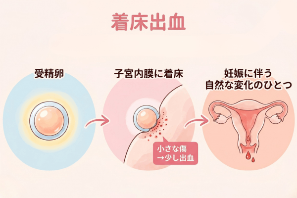 着床痛
