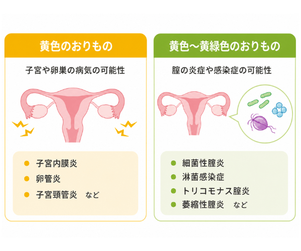 黄色・黄緑色のおりもの