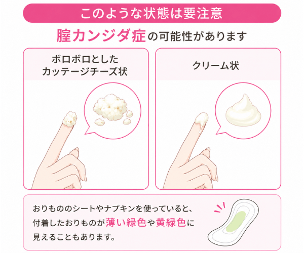 白色のおりもの