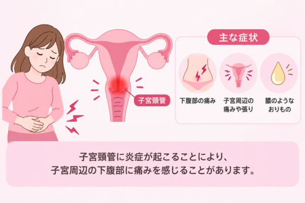 子宮頸管炎