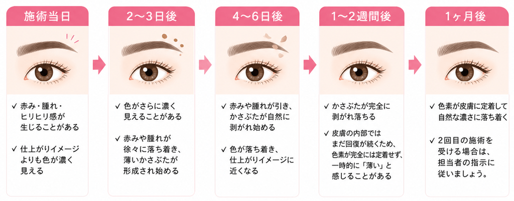 ダウンタイムの期間と日ごとの経過