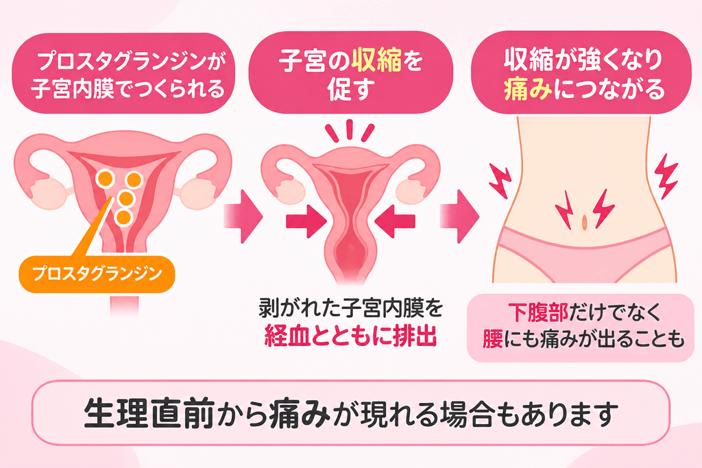 月経に伴う子宮の収縮と痛みの広がり