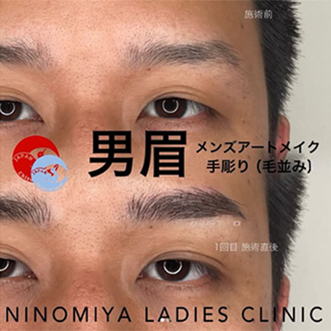 施術のビフォーアフター画像