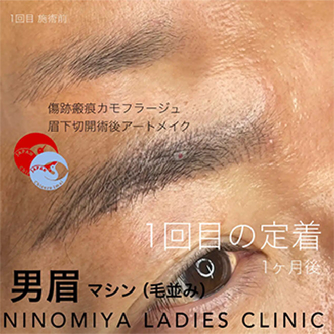 施術のビフォーアフター画像