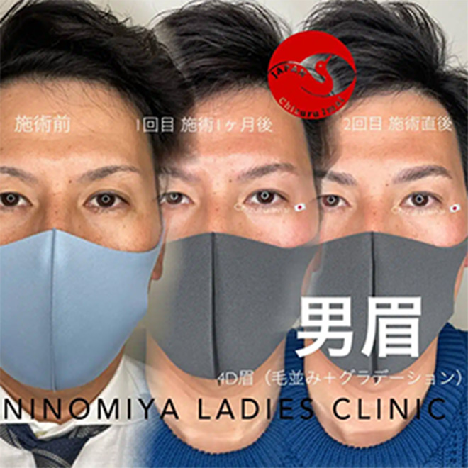 施術のビフォーアフター画像