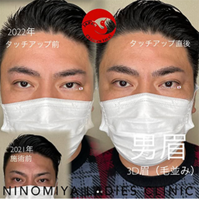 施術のビフォーアフター画像