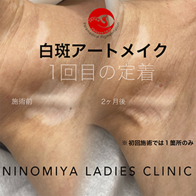 施術のビフォーアフター画像