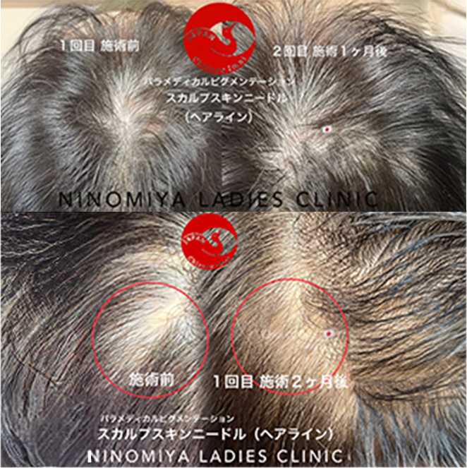 施術のビフォーアフター画像