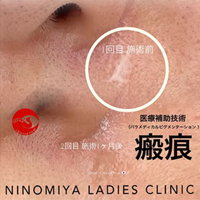 施術のビフォーアフター画像