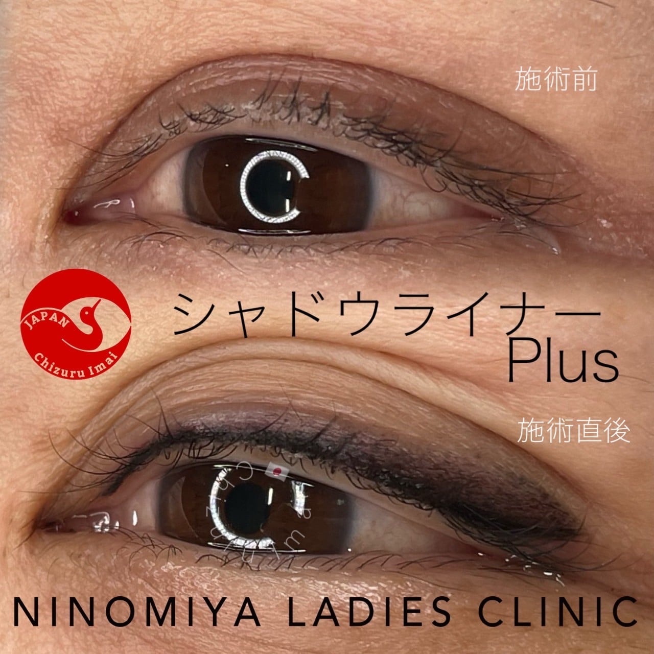 【シャドウライナーPlus】アートメイク