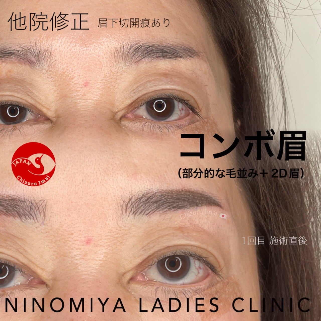 【コンボ眉】アートメイク