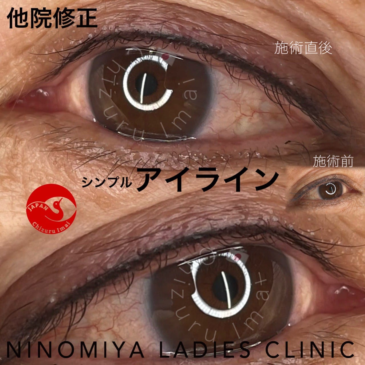 【アイライン】アートメイク