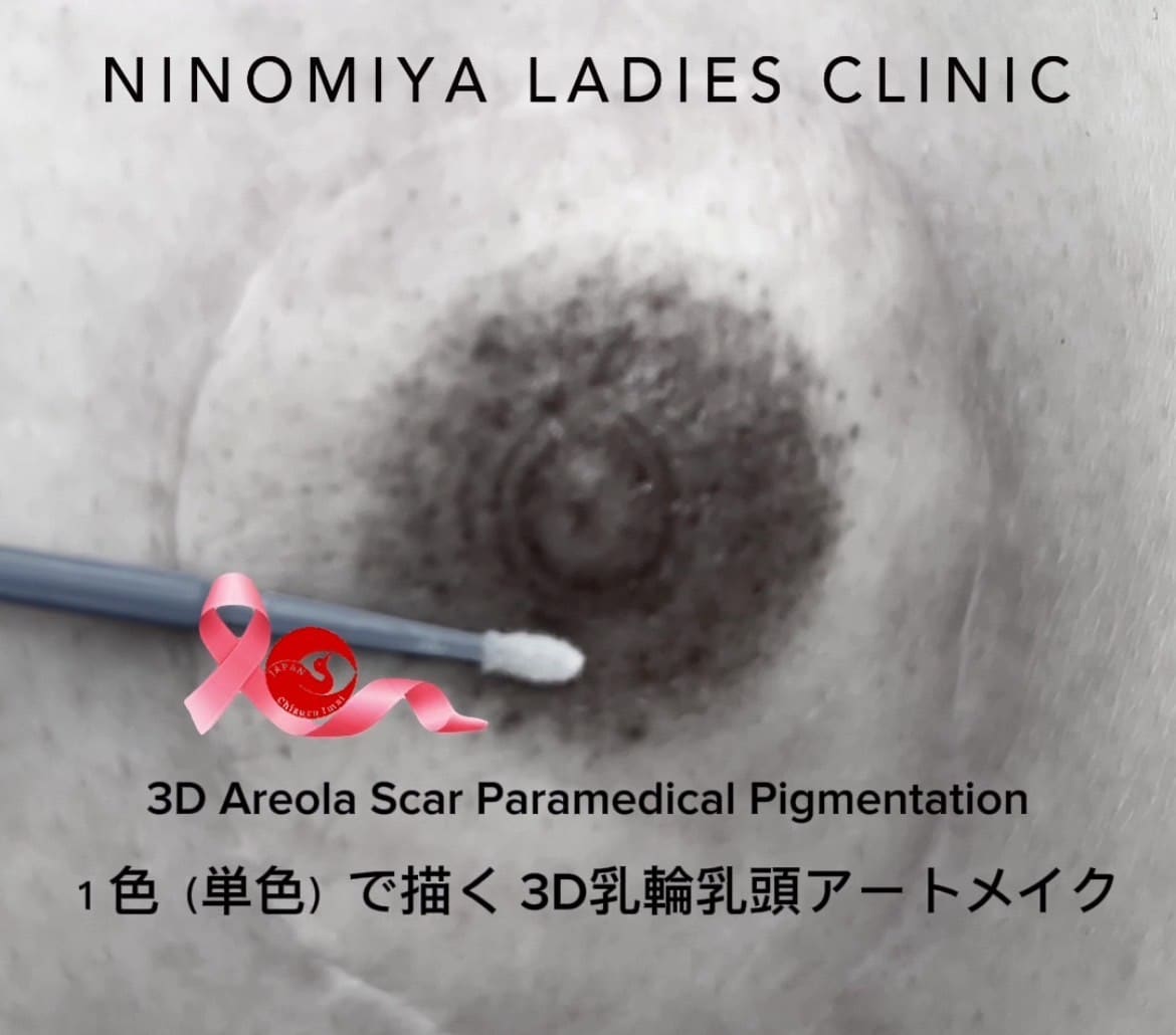 【乳輪・乳頭】医療アートメイク