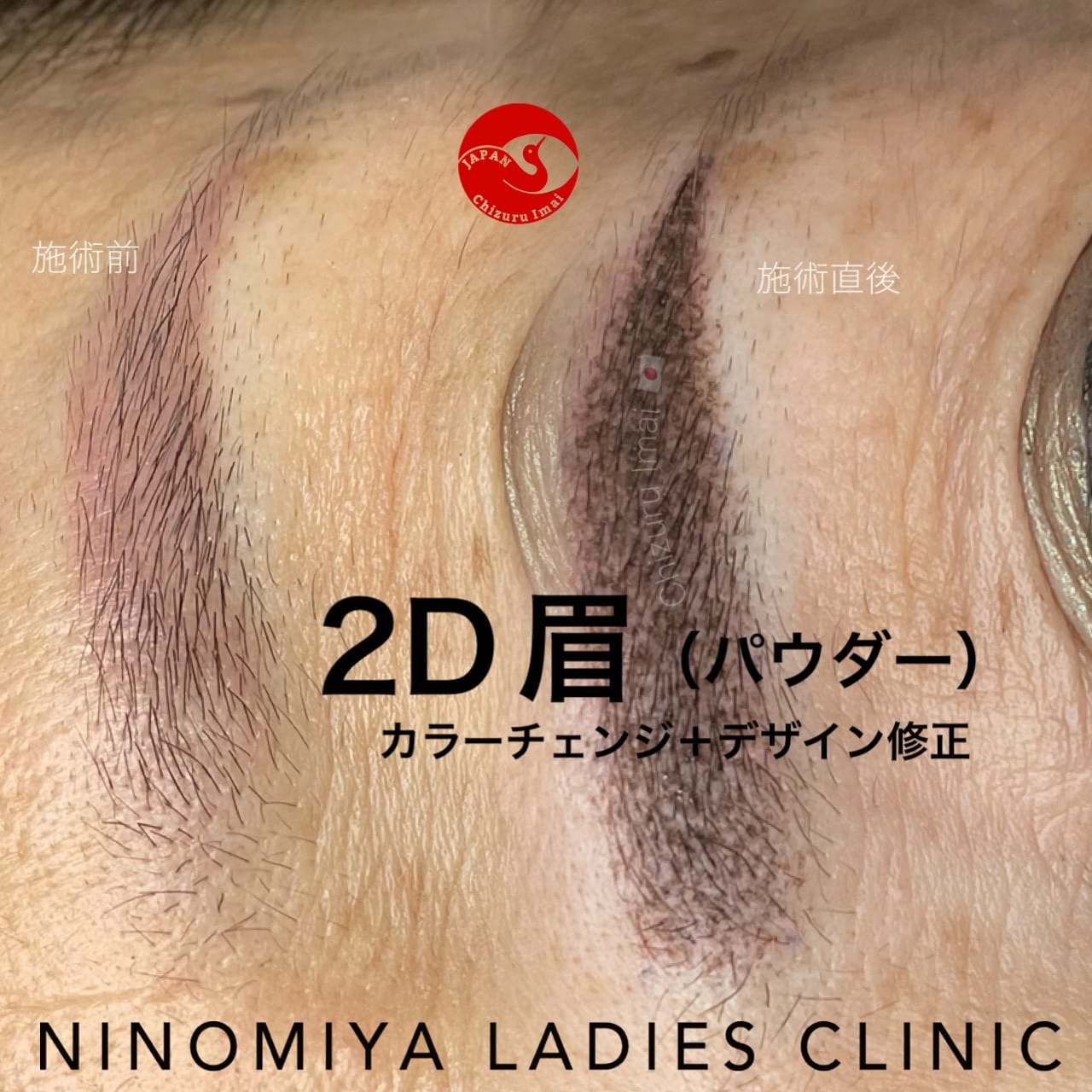 【２D眉】アートメイク