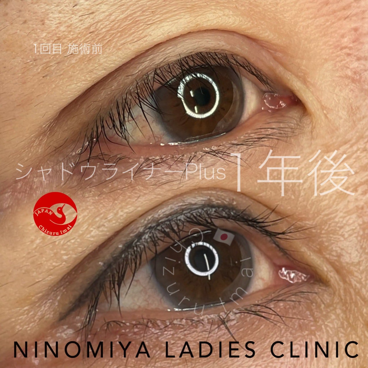 【シャドウライナーPlus】アートメイク