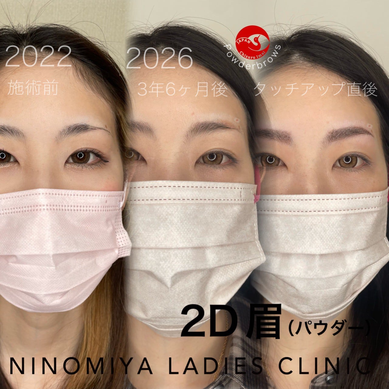 【２D眉】アートメイク